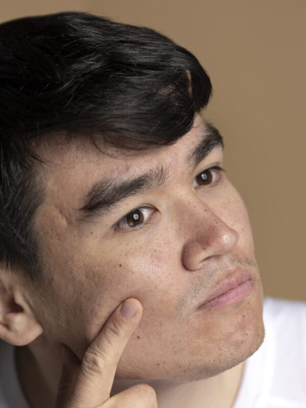 Collagen help Reduce Wrinkles and Fine Lines